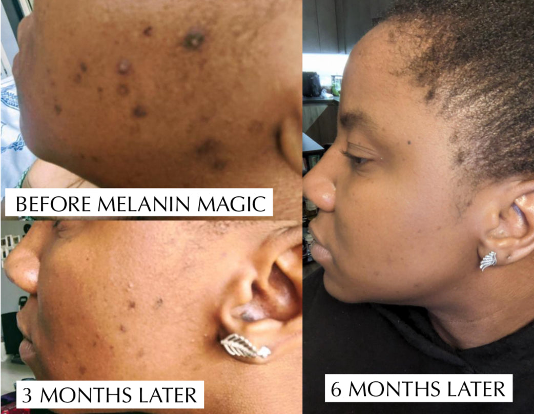 Free Skincare Consultation